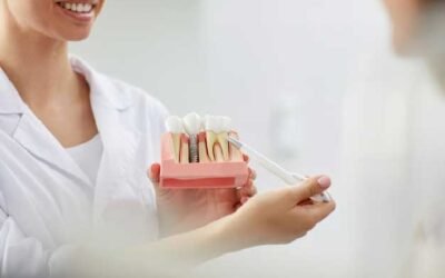 Implantes dentales con poco hueso en Quintana, Ventas y Ciudad Lineal