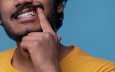 Periodontitis: cómo identificarla, tratarla y proteger tu sonrisa